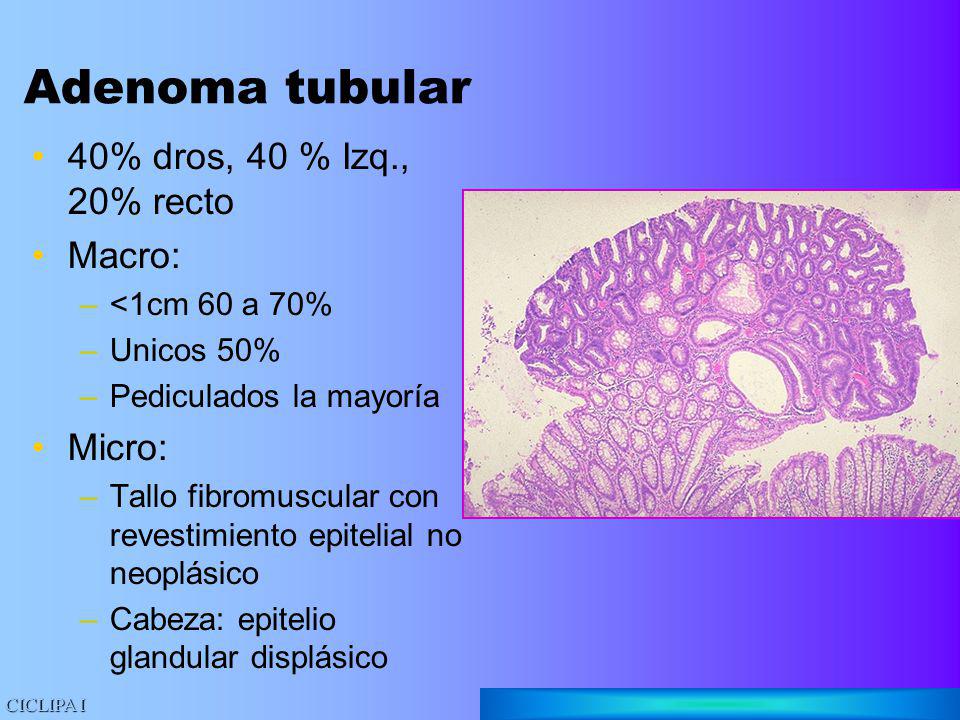 Adenoma tubular 40% dros, 40 % Izq., 20% recto Macro: Micro: