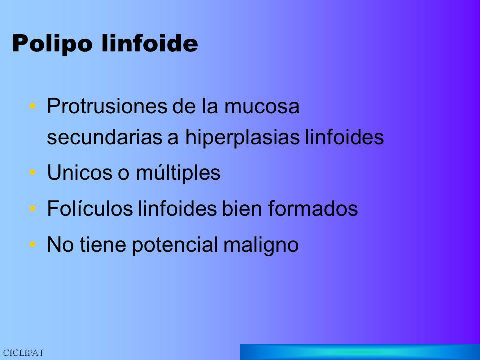Polipo linfoide Protrusiones de la mucosa secundarias a hiperplasias linfoides. Unicos o múltiples.