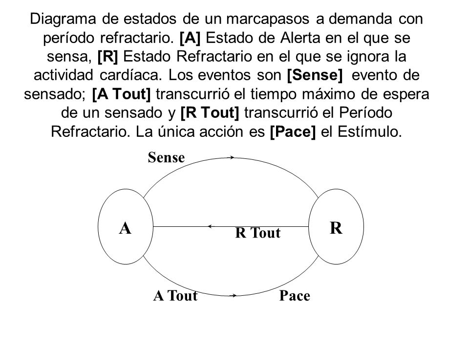 Diagrama de estados de un marcapasos a demanda con período refractario