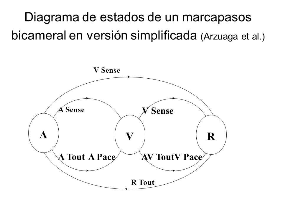 Diagrama de estados de un marcapasos bicameral en versión simplificada (Arzuaga et al.)