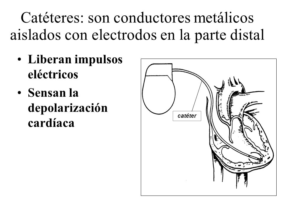 Catéteres: son conductores metálicos aislados con electrodos en la parte distal
