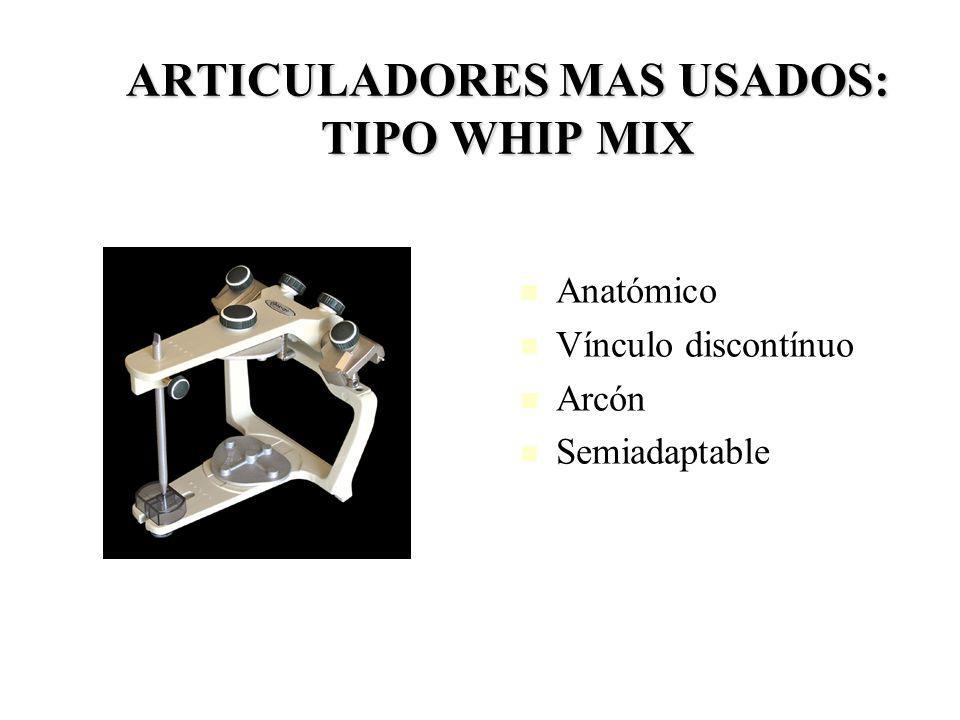 ARTICULADORES MAS USADOS: TIPO WHIP MIX