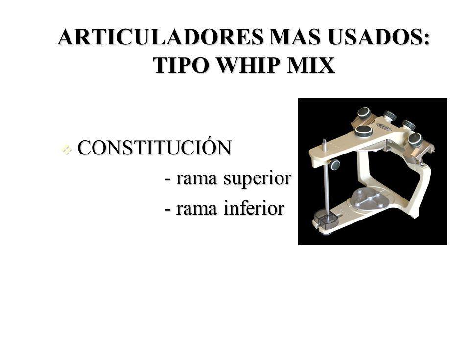 ARTICULADORES MAS USADOS: TIPO WHIP MIX