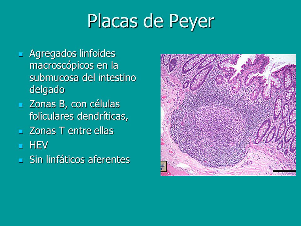 Placas de Peyer Agregados linfoides macroscópicos en la submucosa del intestino delgado. Zonas B, con células foliculares dendríticas,