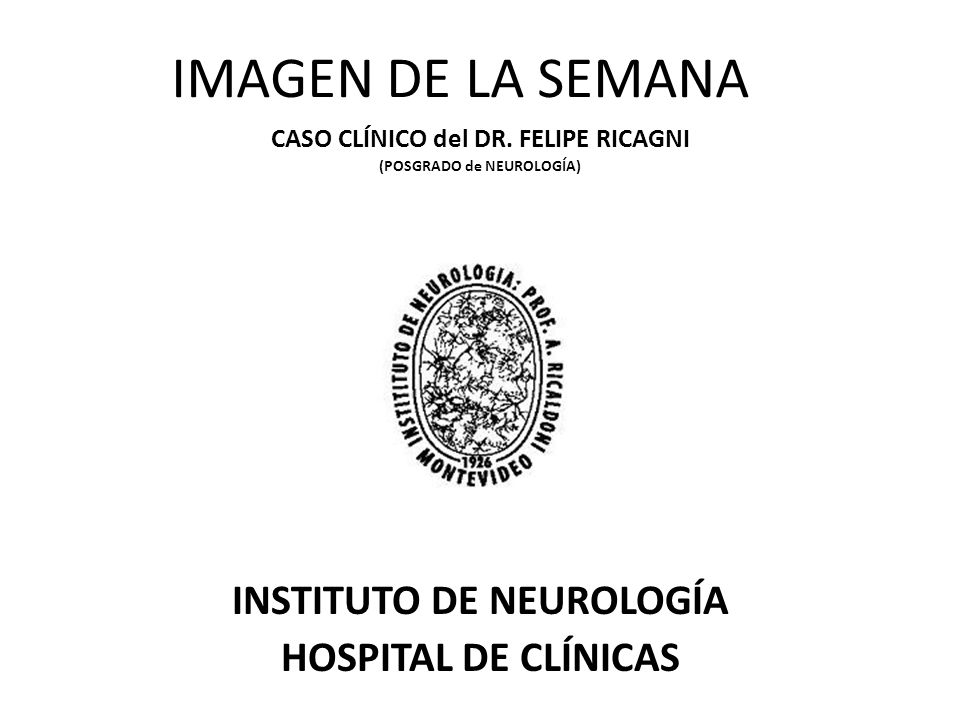 IMAGEN DE LA SEMANA INSTITUTO DE NEUROLOGÍA HOSPITAL DE CLÍNICAS