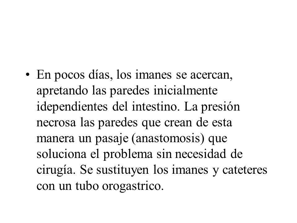 En pocos días, los imanes se acercan, apretando las paredes inicialmente idependientes del intestino.
