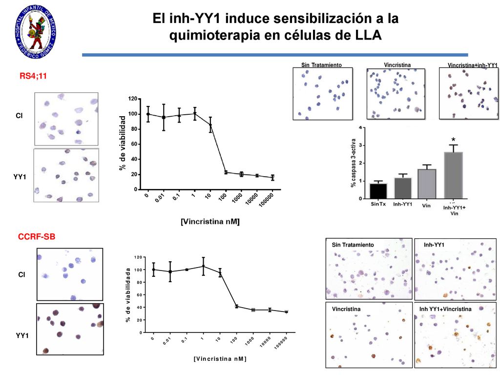 El inh-YY1 induce sensibilización a la quimioterapia en células de LLA