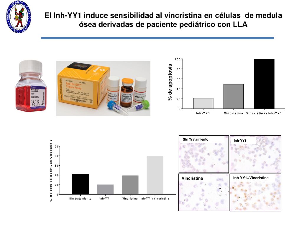 El Inh-YY1 induce sensibilidad al vincristina en células de medula ósea derivadas de paciente pediátrico con LLA