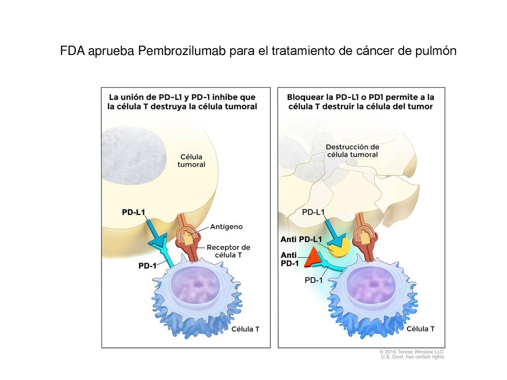 FDA aprueba Pembrozilumab para el tratamiento de cáncer de pulmón