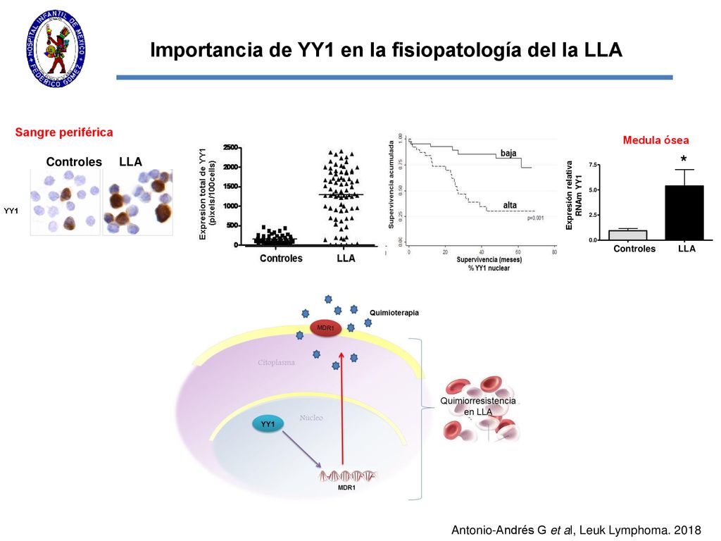 Importancia de YY1 en la fisiopatología del la LLA