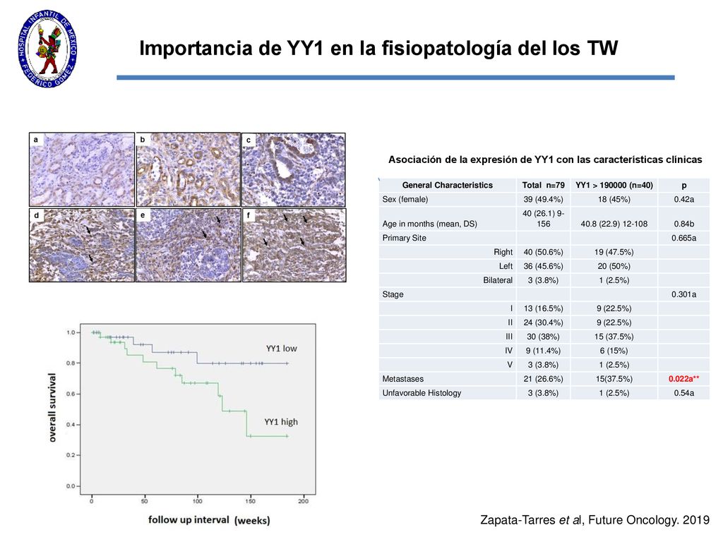 Importancia de YY1 en la fisiopatología del los TW