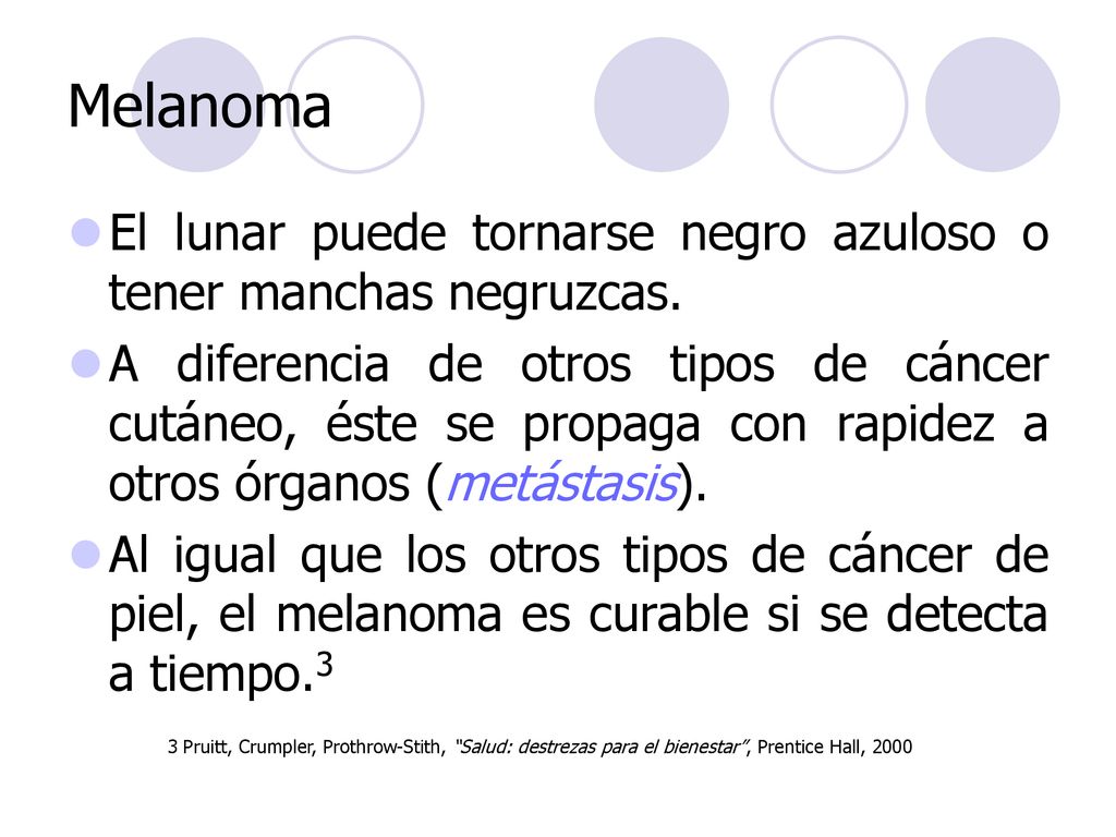 Melanoma El lunar puede tornarse negro azuloso o tener manchas negruzcas.