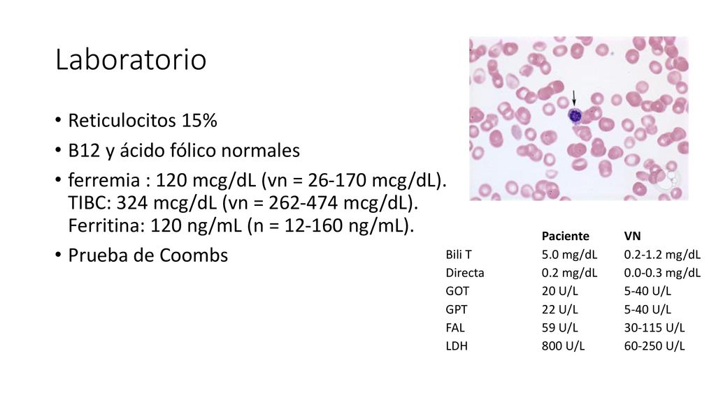 Laboratorio Reticulocitos 15% B12 y ácido fólico normales