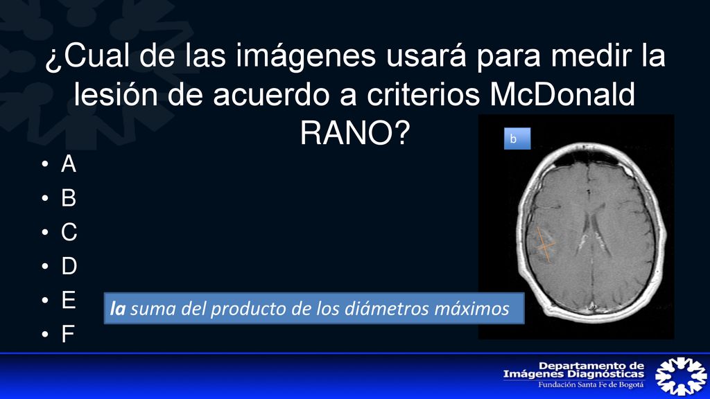 ¿Cual de las imágenes usará para medir la lesión de acuerdo a criterios McDonald RANO