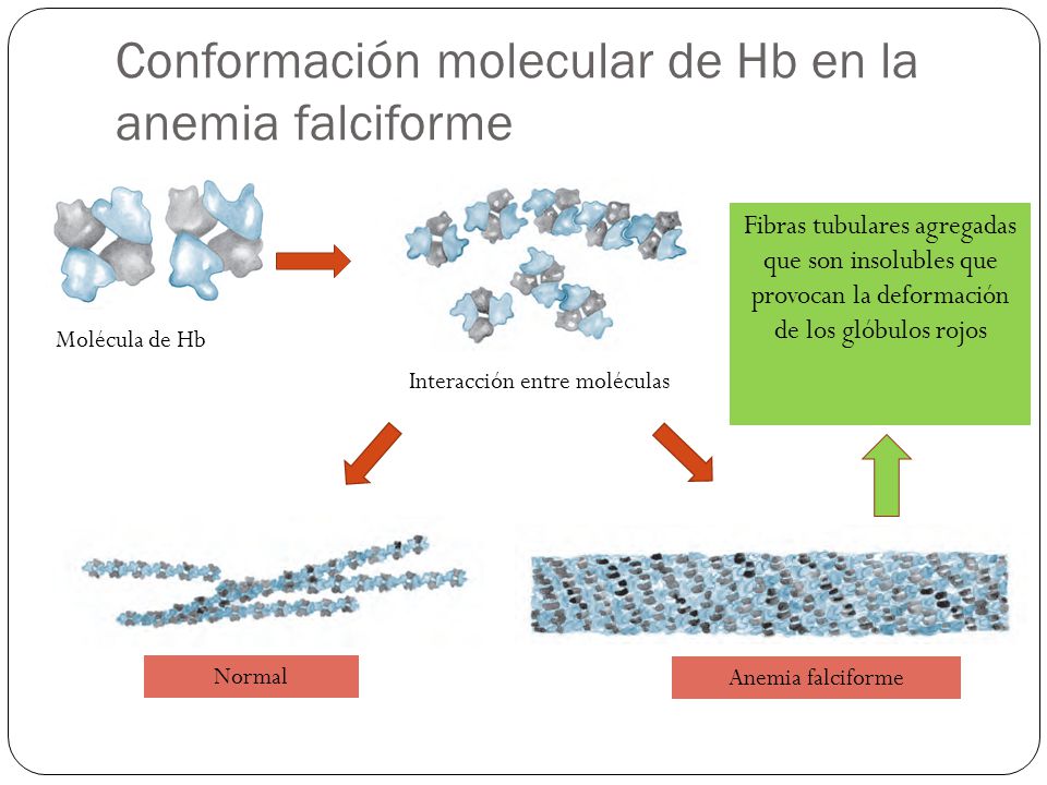 Conformación molecular de Hb en la anemia falciforme