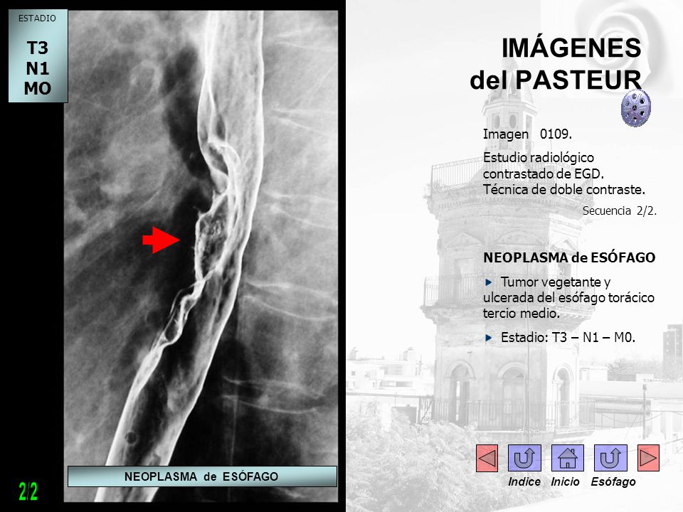 2/2 IMÁGENES del PASTEUR T3 N1 MO - - Imagen 0109.
