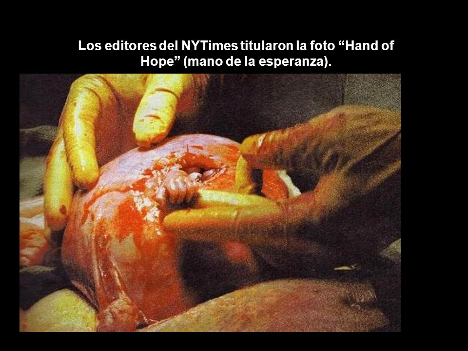 Los editores del NYTimes titularon la foto Hand of Hope (mano de la esperanza).