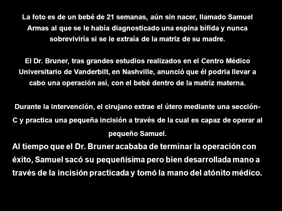 La foto es de un bebé de 21 semanas, aún sin nacer, llamado Samuel Armas al que se le había diagnosticado una espina bífida y nunca sobreviviría si se le extraía de la matriz de su madre.
