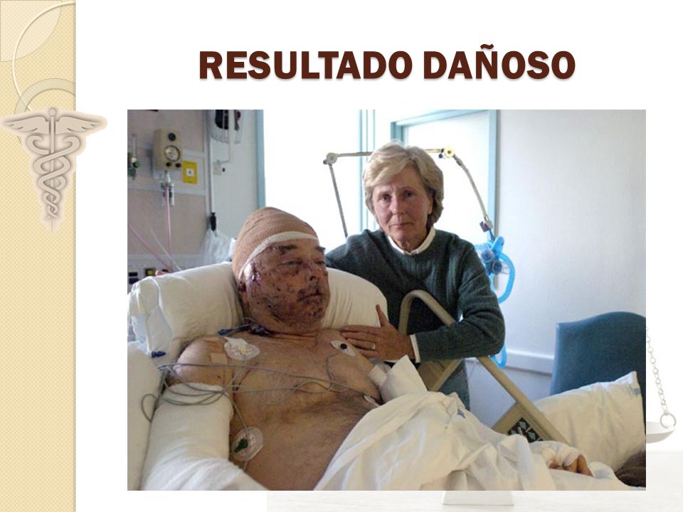 RESULTADO DAÑOSO