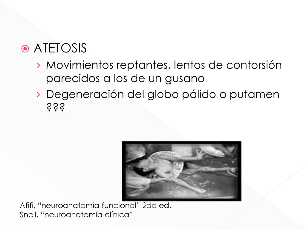 ATETOSIS Movimientos reptantes, lentos de contorsión parecidos a los de un gusano. Degeneración del globo pálido o putamen