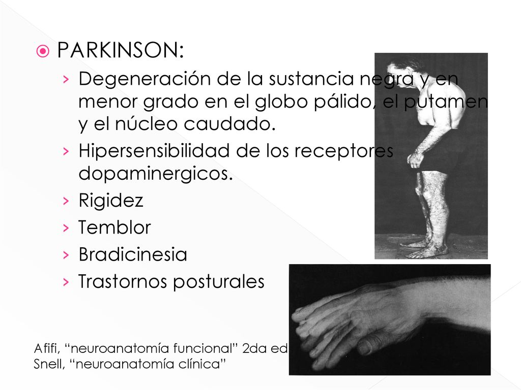 PARKINSON: Degeneración de la sustancia negra y en menor grado en el globo pálido, el putamen y el núcleo caudado.