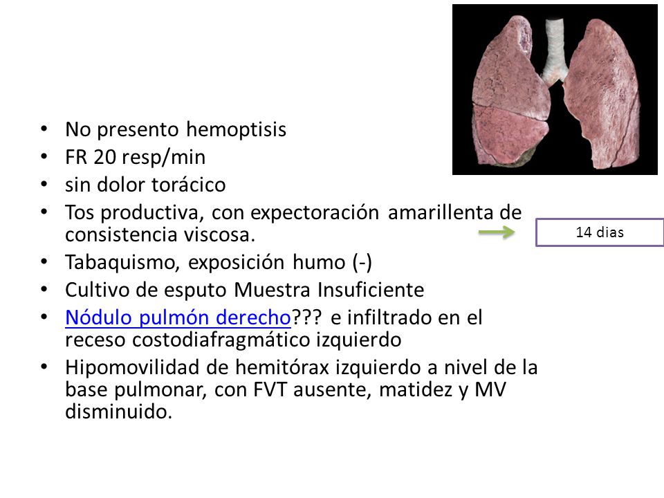 No presento hemoptisis FR 20 resp/min sin dolor torácico