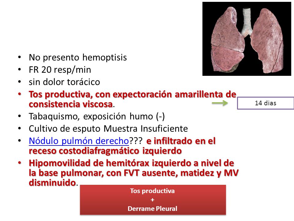 No presento hemoptisis FR 20 resp/min sin dolor torácico