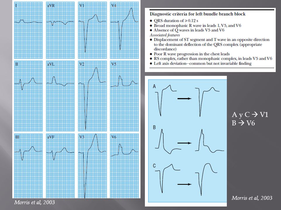 A y C  V1 B  V6 Morris et al, 2003 Morris et al, 2003