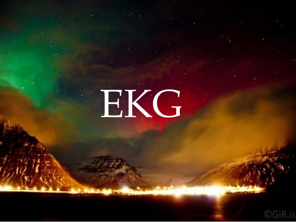 EKG EKG