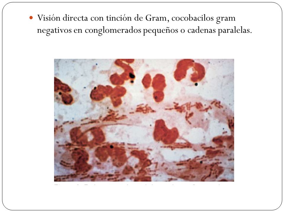Visión directa con tinción de Gram, cocobacilos gram negativos en conglomerados pequeños o cadenas paralelas.