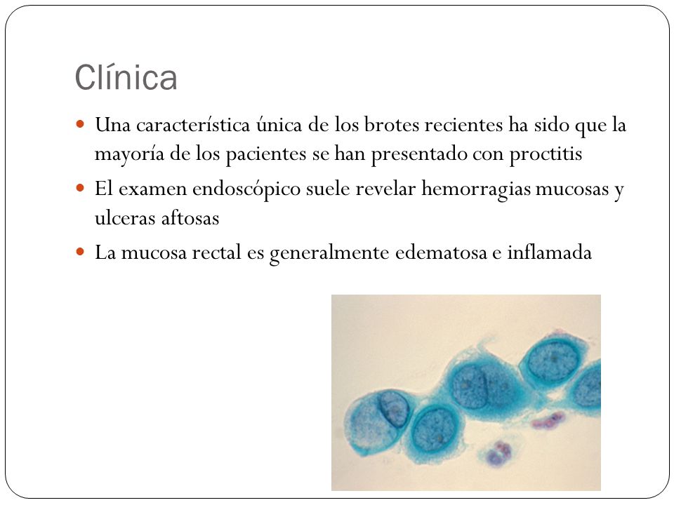 Clínica Una característica única de los brotes recientes ha sido que la mayoría de los pacientes se han presentado con proctitis.