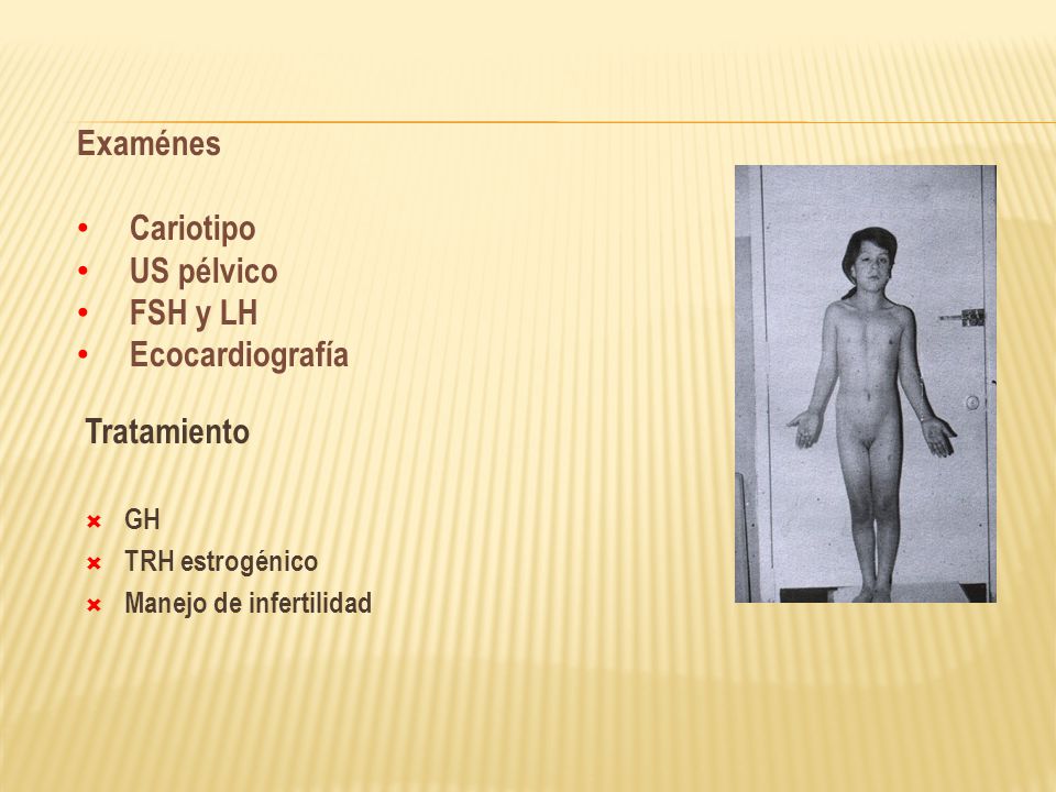 Examénes Cariotipo US pélvico FSH y LH Ecocardiografía Tratamiento GH