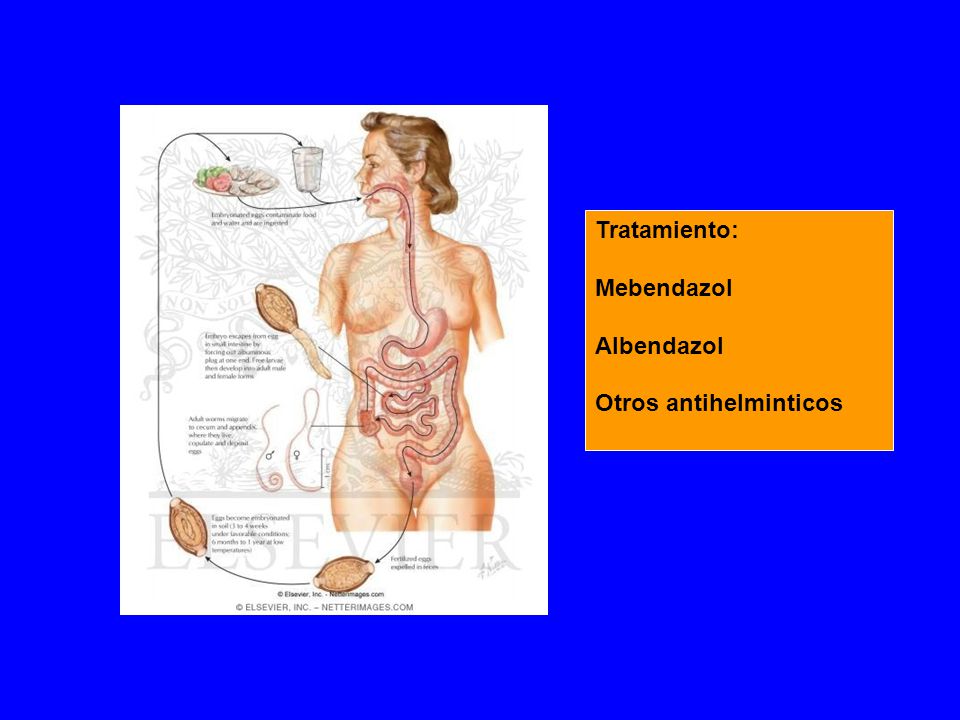 Tratamiento: Mebendazol Albendazol Otros antihelminticos