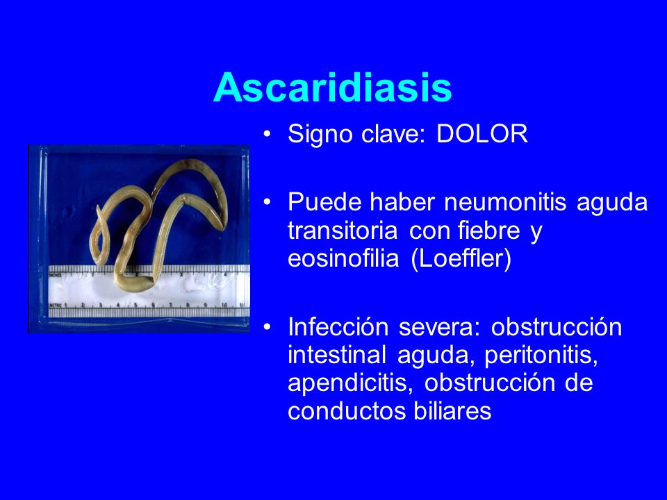 Ascaridiasis Signo clave: DOLOR