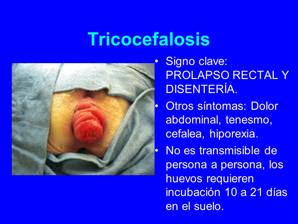 Tricocefalosis Signo clave: PROLAPSO RECTAL Y DISENTERÍA.