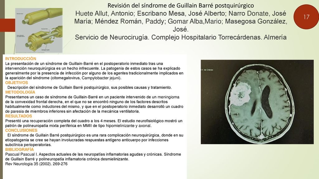 Revisión del síndrome de Guillain Barré postquirúrgico Huete Allut, Antonio; Escribano Mesa, José Alberto; Narro Donate, José María; Méndez Román, Paddy; Gomar Alba,Mario; Masegosa González, José. Servicio de Neurocirugía. Complejo Hospitalario Torrecárdenas. Almería