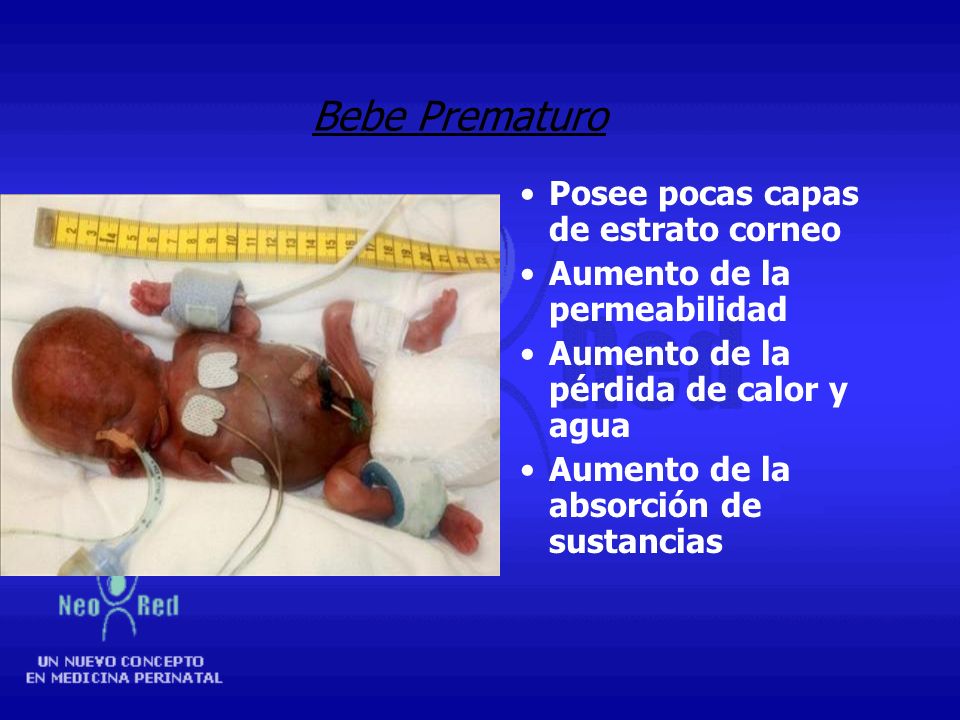 Bebe Prematuro Posee pocas capas de estrato corneo