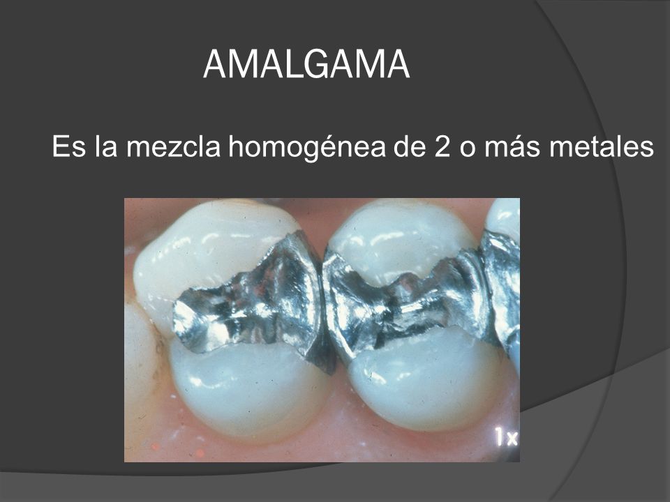 AMALGAMA Es la mezcla homogénea de 2 o más metales Concepto