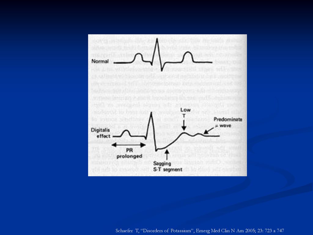 Schaefer T, Disorders of Potassium , Emerg Med Clin N Am 2005; 23: 723 a 747