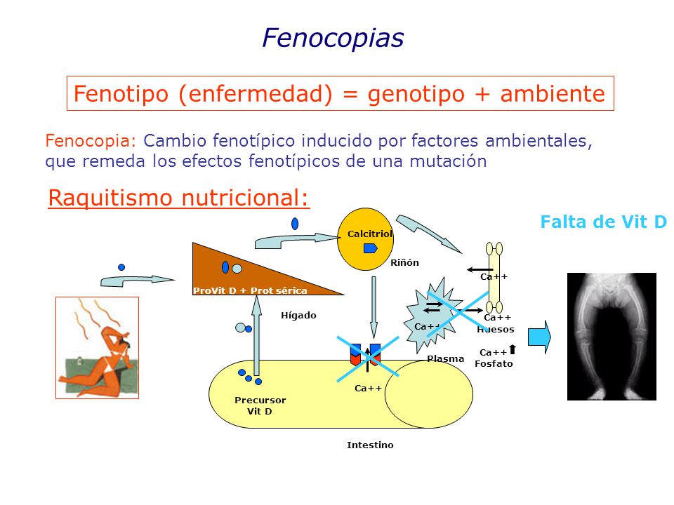 Fenocopias Fenotipo (enfermedad) = genotipo + ambiente