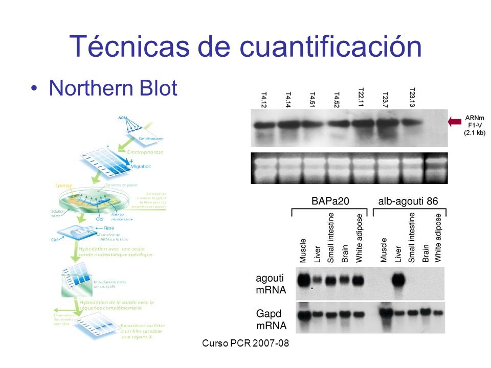 Técnicas de cuantificación