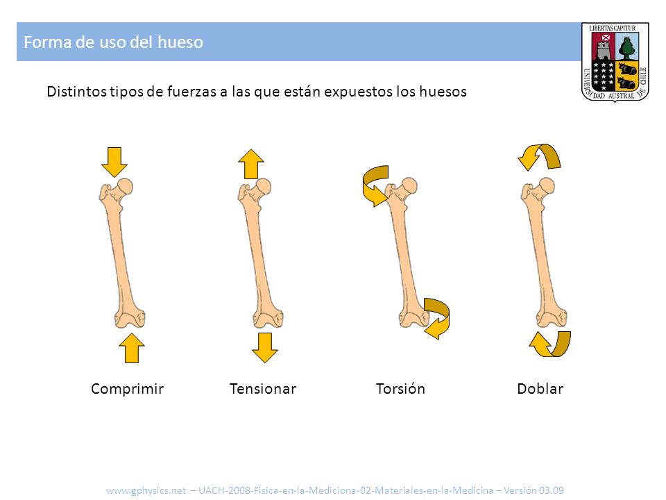 Forma de uso del hueso Distintos tipos de fuerzas a las que están expuestos los huesos. Comprimir.