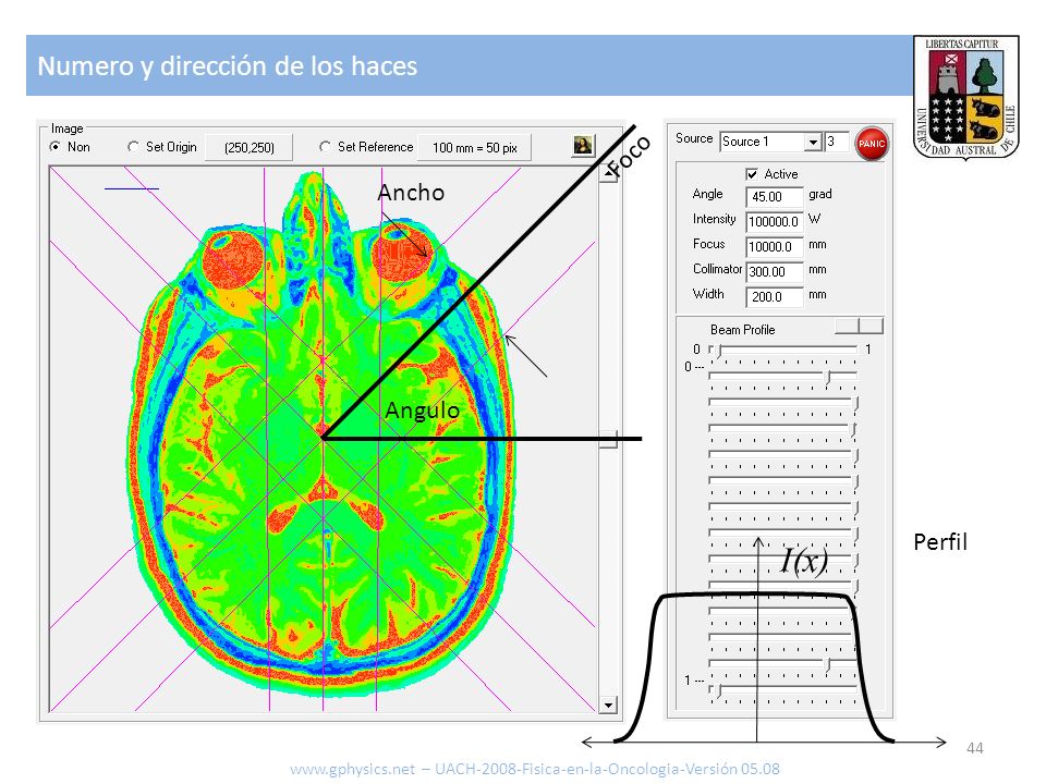 I(x) Numero y dirección de los haces Foco Ancho Angulo Perfil