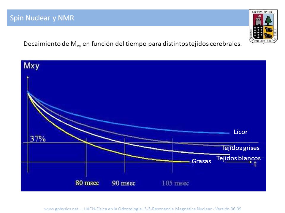 Spin Nuclear y NMR Decaimiento de Mxy en función del tiempo para distintos tejidos cerebrales. Licor.