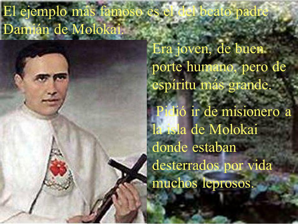 El ejemplo más famoso es el del beato padre Damián de Molokai.