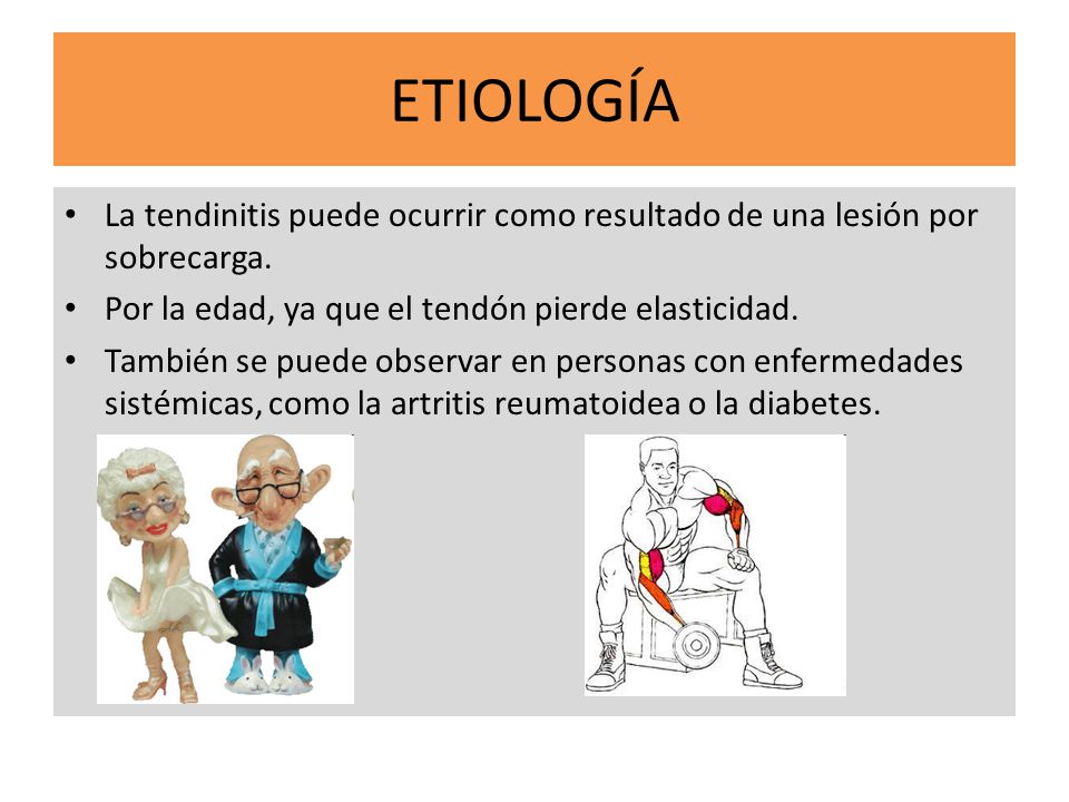 ETIOLOGÍA La tendinitis puede ocurrir como resultado de una lesión por sobrecarga. Por la edad, ya que el tendón pierde elasticidad.
