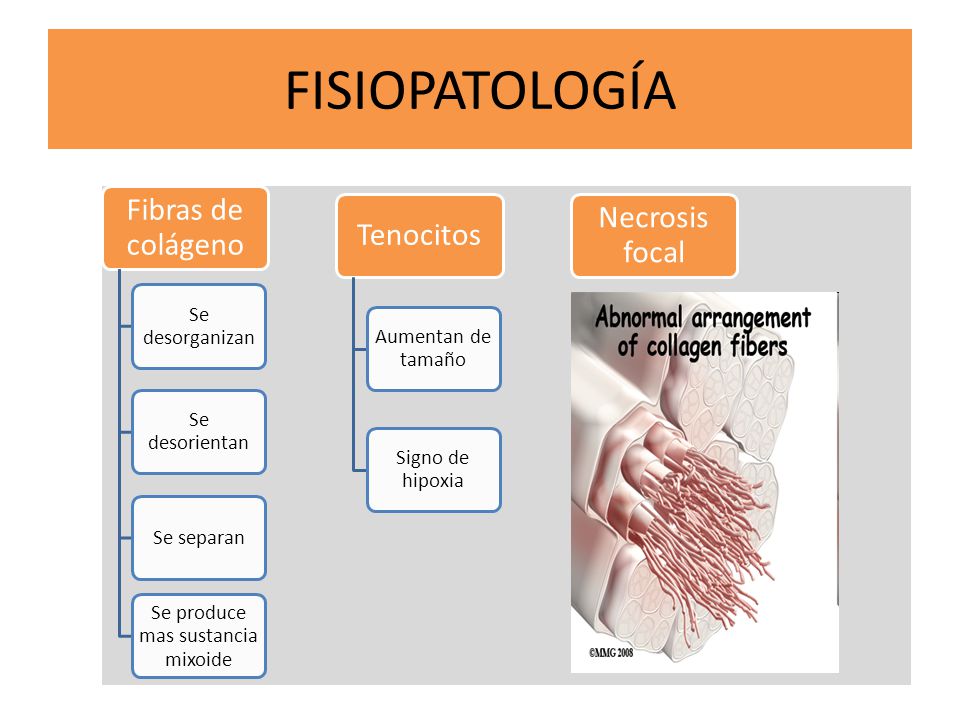 Se produce mas sustancia mixoide