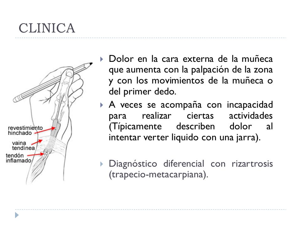 CLINICA Dolor en la cara externa de la muñeca que aumenta con la palpación de la zona y con los movimientos de la muñeca o del primer dedo.