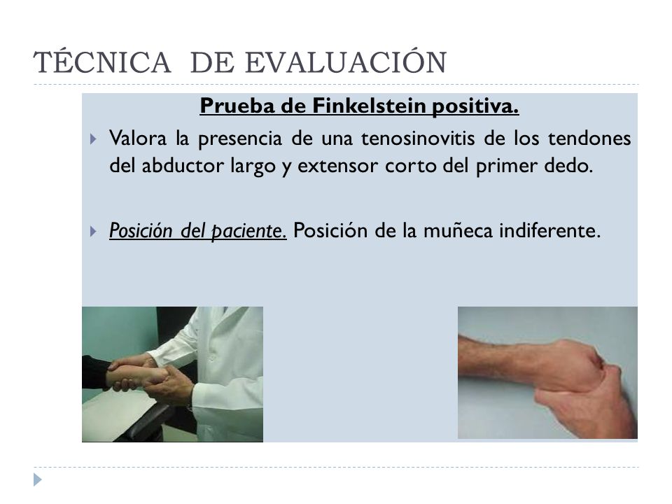 Prueba de Finkelstein positiva.