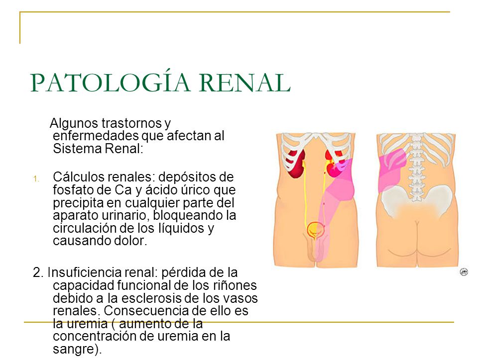PATOLOGÍA RENAL Algunos trastornos y enfermedades que afectan al Sistema Renal: